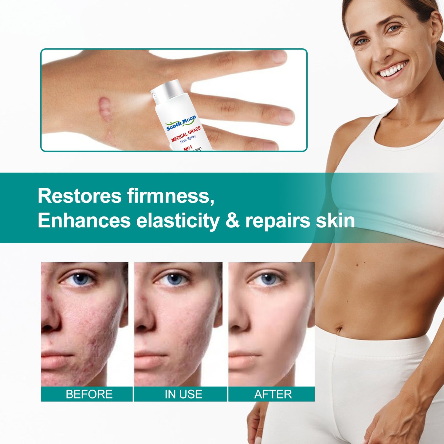 MEDICAL GRADE SCAR SPRAY
