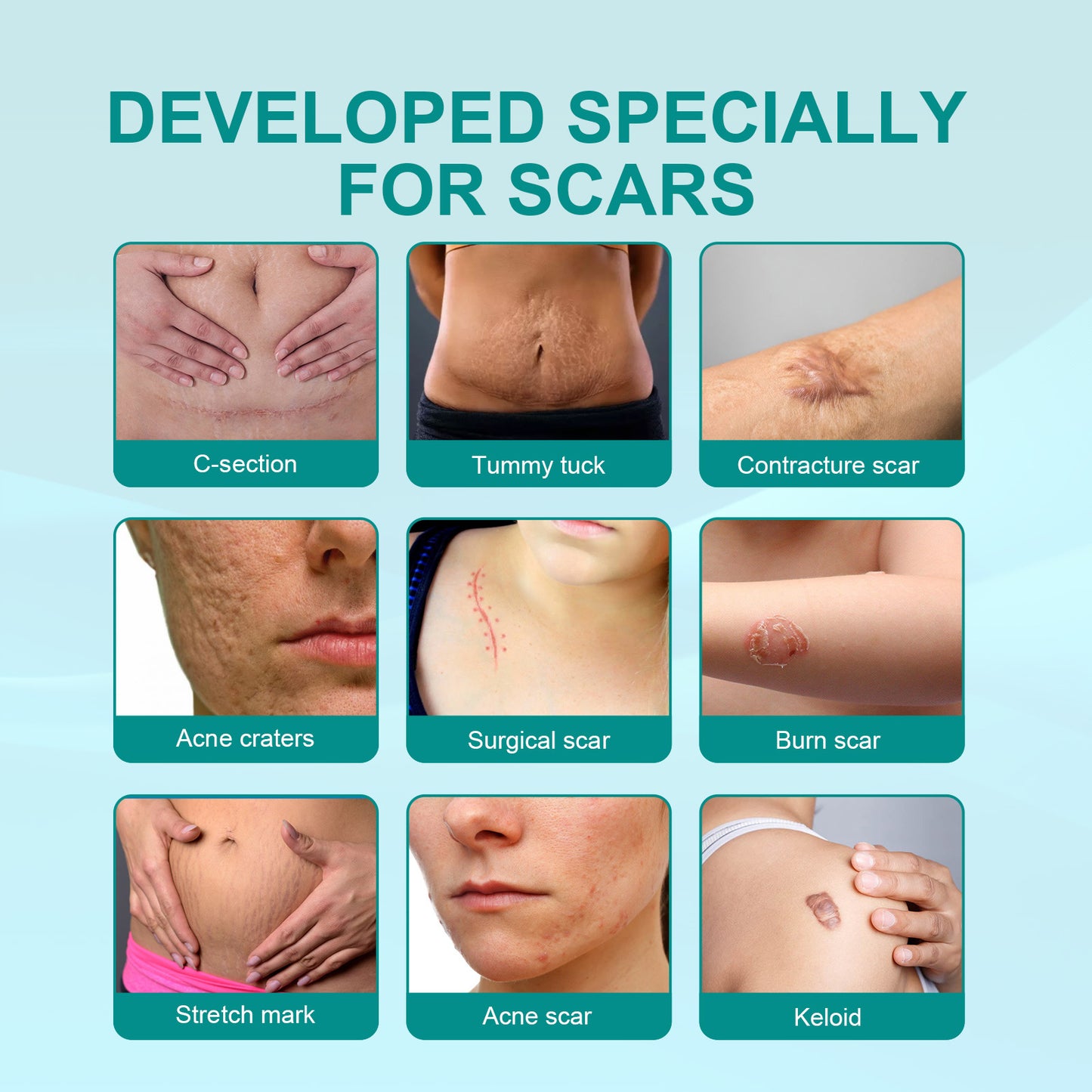 MEDICAL GRADE SCAR SPRAY