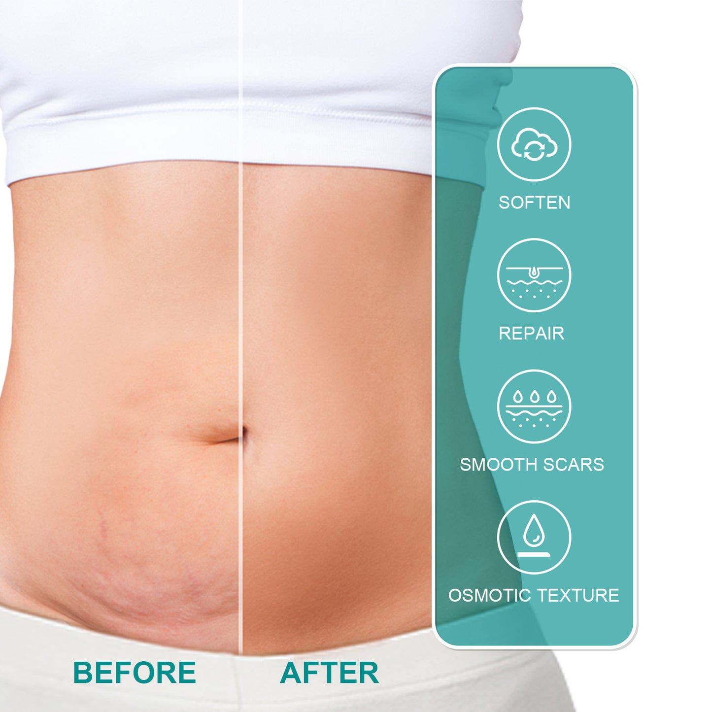 MEDICAL GRADE SCAR SPRAY